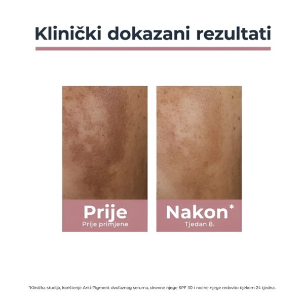 Eucerin Anti-Pigment dnevna njega SPF30 - Image 4