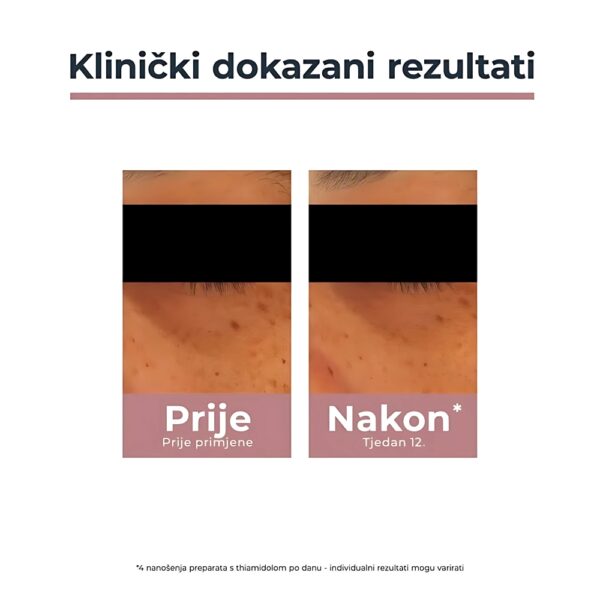 Eucerin Anti-Pigment krema za područje oko očiju - Image 6